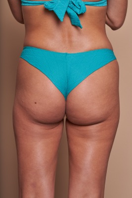 Tanga - ADDICT Riv lagon